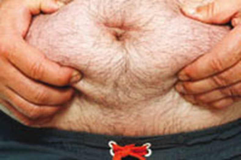 Fat-belly-3x2.jpg