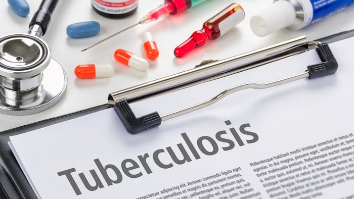 Tuberculosis
