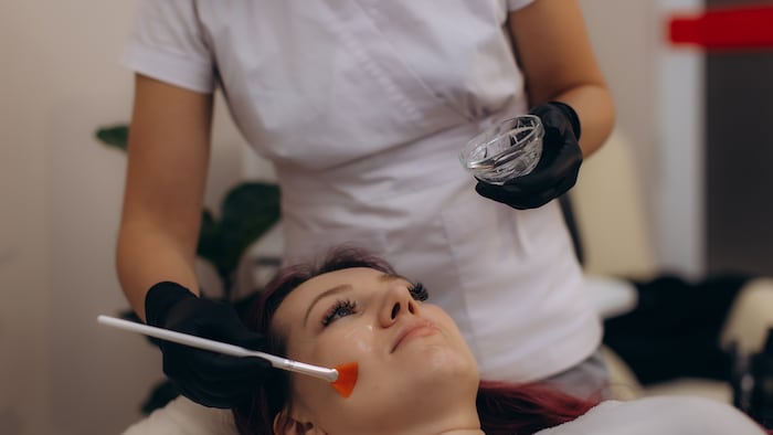 Chemical peel