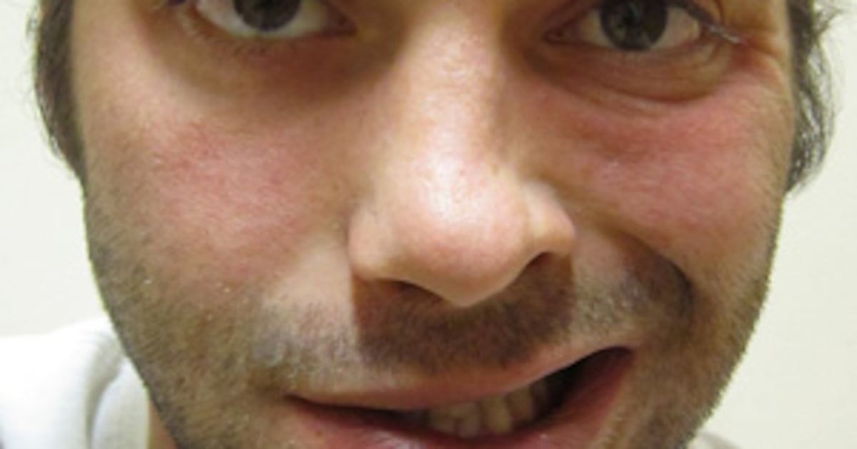 Lopsided Expression Does a lopsided face indicate a stroke?
